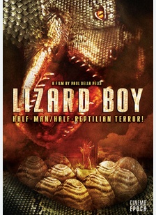 Lizard Boy