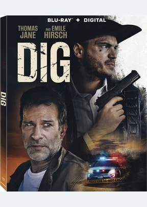 DIG (BR)
