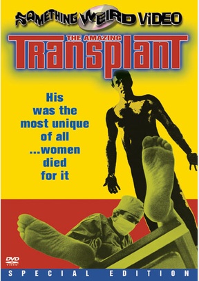 The Amazing Transplant