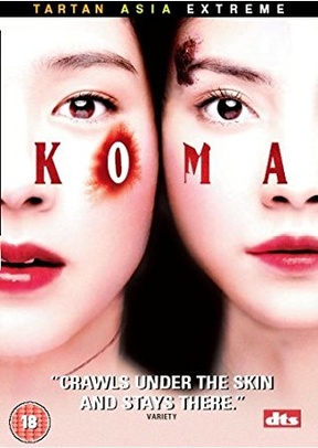 KOMA