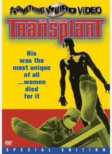 The Amazing Transplant