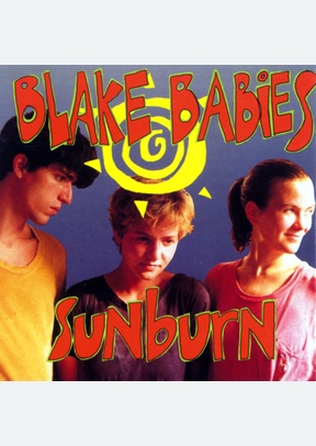 SUNBURN
