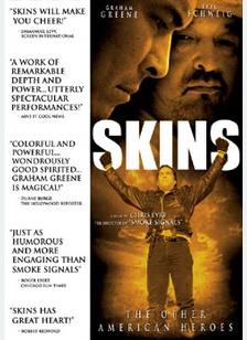 Skins