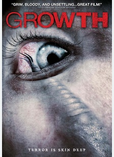 Growth
