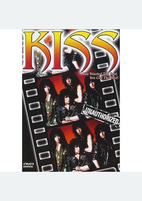 Kiss