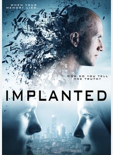 Implanted