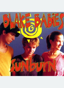 SUNBURN
