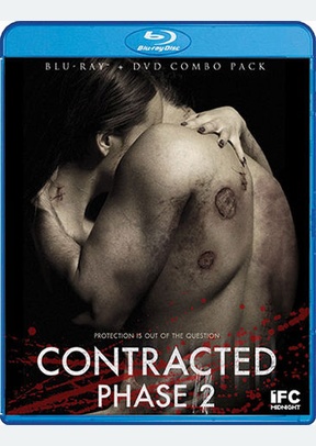 Contracted: Phase II