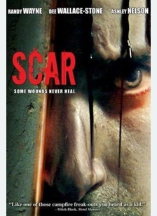 Scar