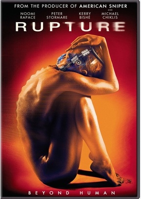 Rupture