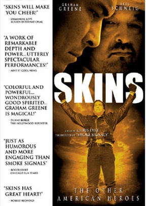 Skins