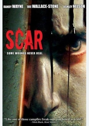 Scar