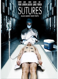 Sutures