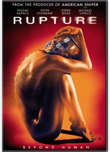 Rupture