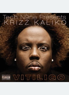 Vitiligo