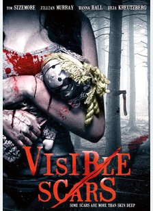 Visible Scars